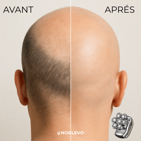 GlideShave™ – Rasoir électrique ultime pour hommes chauves