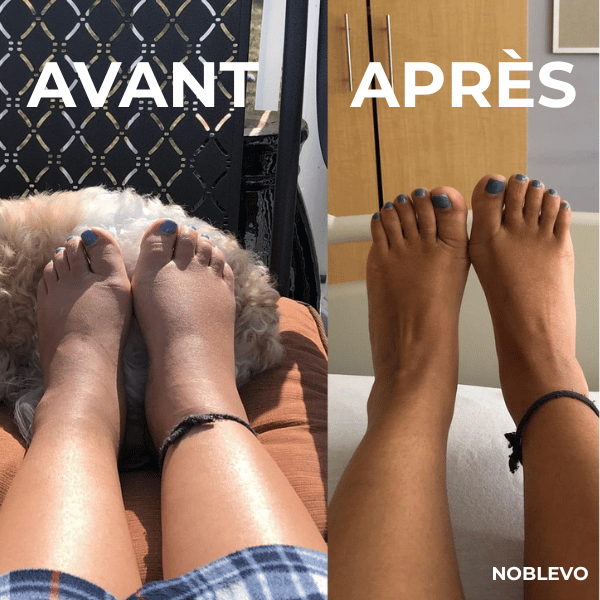Podévo™